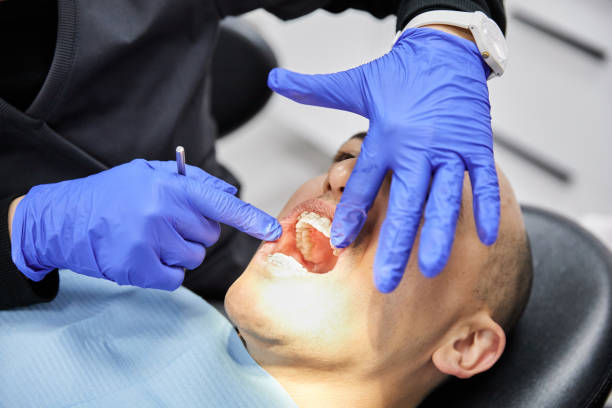 Best Chipped Tooth Repair Near Me  in Birchwood Lakes, PA